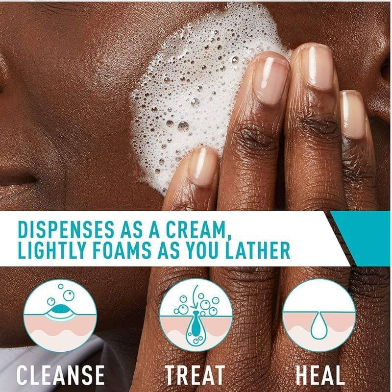 CeraVe Acne Foaming Cream Cleanser – 150ml CeraVe Acne Foaming Cream Cleanser – 150ml - Image 2